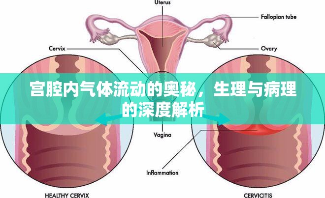 宮腔內(nèi)氣體流動(dòng)的奧秘，生理與病理的深度解析
