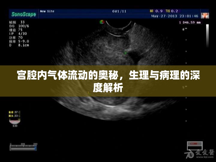 宮腔內(nèi)氣體流動(dòng)的奧秘，生理與病理的深度解析