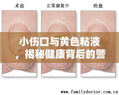 小傷口與黃色粘液，揭秘健康背后的警示信號