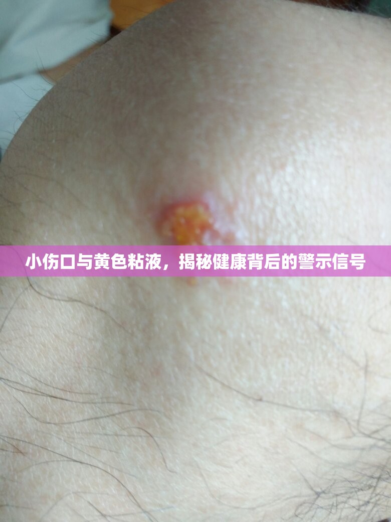 小傷口與黃色粘液，揭秘健康背后的警示信號