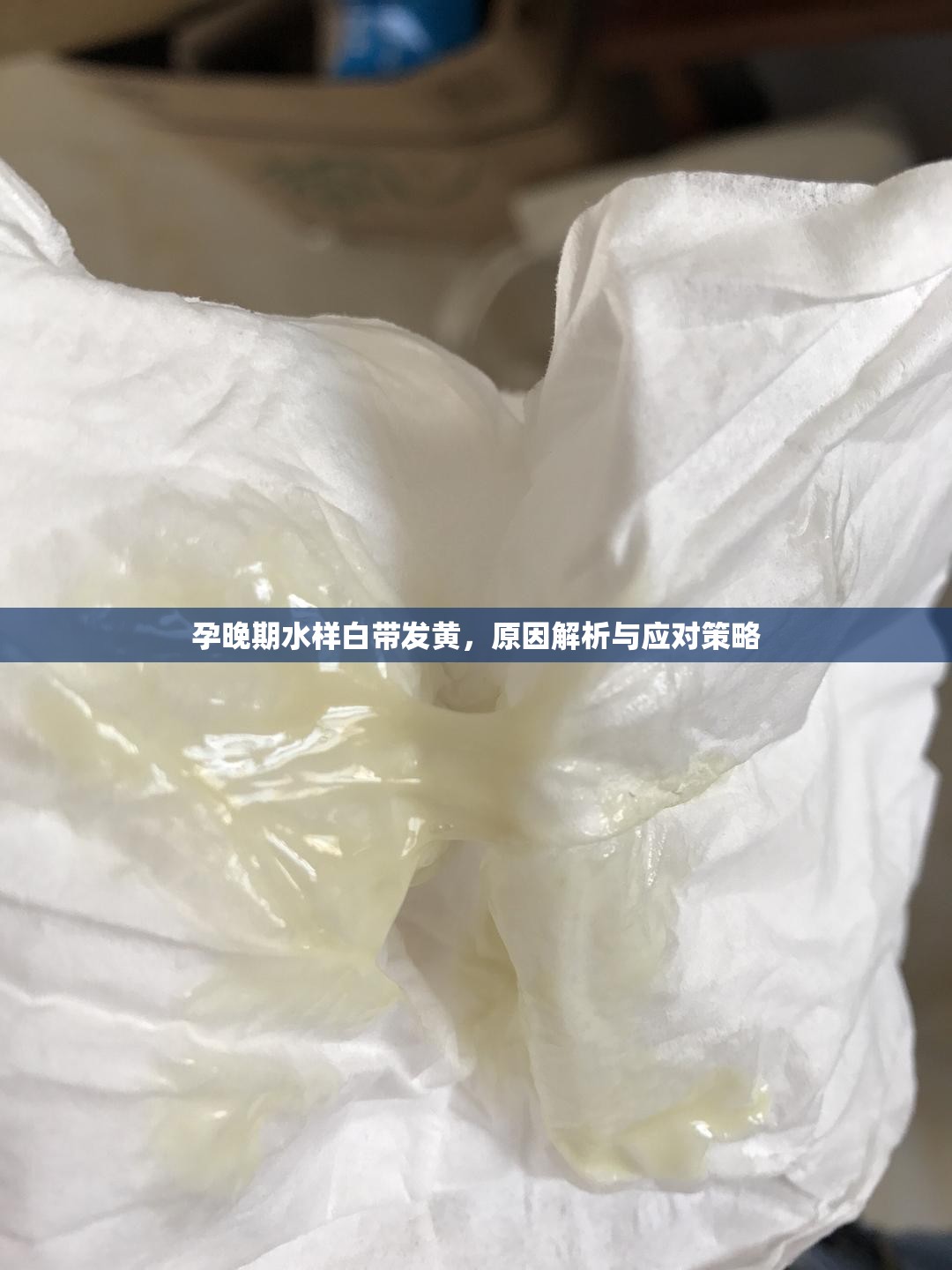 孕晚期水樣白帶發(fā)黃，原因解析與應(yīng)對策略