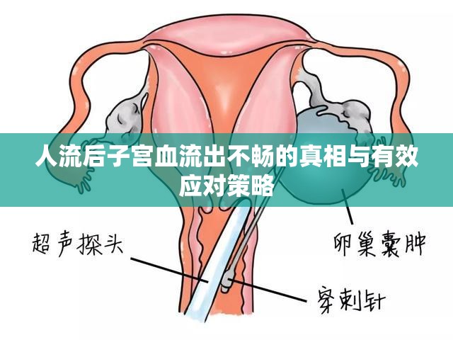 人流后子宮血流出不暢的真相與有效應(yīng)對策略
