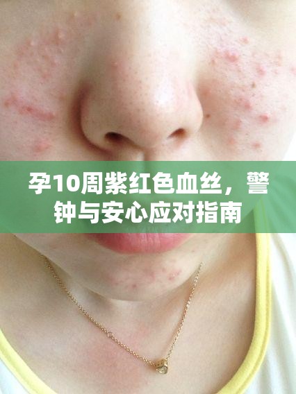 孕10周紫紅色血絲，警鐘與安心應(yīng)對指南