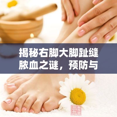 揭秘右腳大腳趾縫膿血之謎，預(yù)防與應(yīng)對(duì)策略