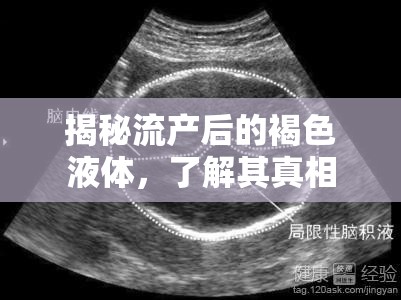 揭秘流產(chǎn)后的褐色液體，了解其真相