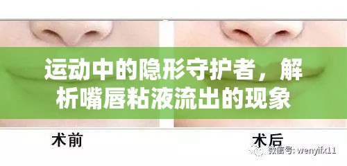運(yùn)動(dòng)中的隱形守護(hù)者，解析嘴唇粘液流出的現(xiàn)象