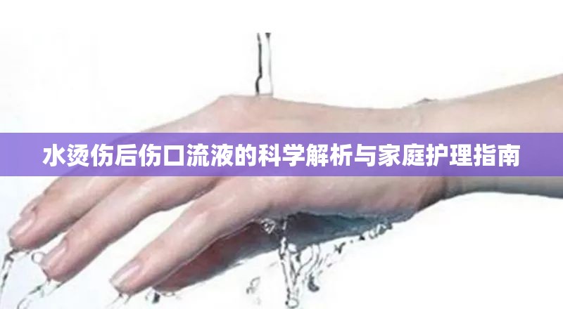 水燙傷后傷口流液的科學(xué)解析與家庭護(hù)理指南