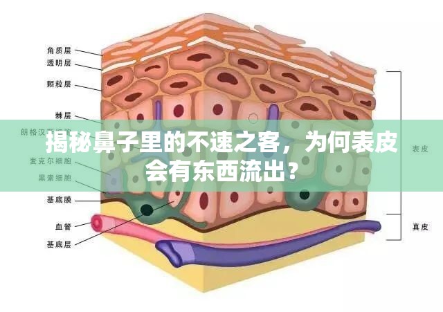 揭秘鼻子里的不速之客，為何表皮會(huì)有東西流出？