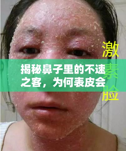揭秘鼻子里的不速之客，為何表皮會(huì)有東西流出？