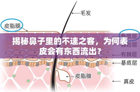 揭秘鼻子里的不速之客，為何表皮會(huì)有東西流出？