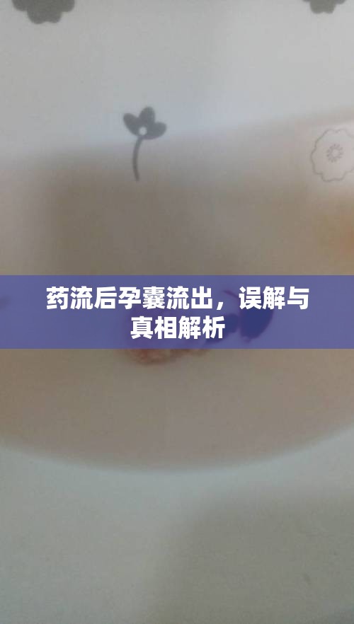 藥流后孕囊流出，誤解與真相解析