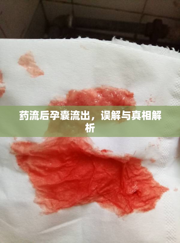 藥流后孕囊流出，誤解與真相解析