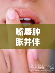嘴唇腫脹并伴有白色物體流出，你需要了解的唇部異常解密