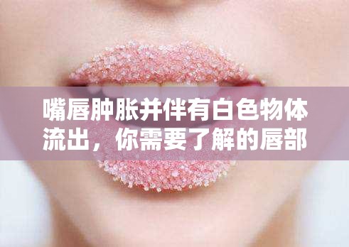 嘴唇腫脹并伴有白色物體流出，你需要了解的唇部異常解密