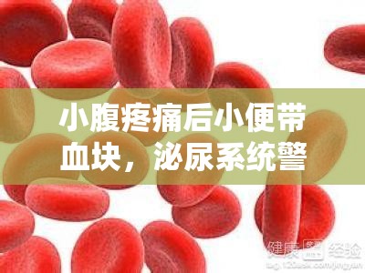 小腹疼痛后小便帶血塊，泌尿系統(tǒng)警報(bào)不容忽視