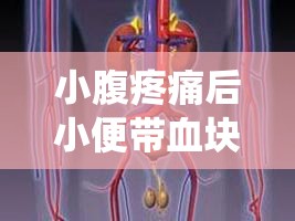 小腹疼痛后小便帶血塊，泌尿系統(tǒng)警報(bào)不容忽視