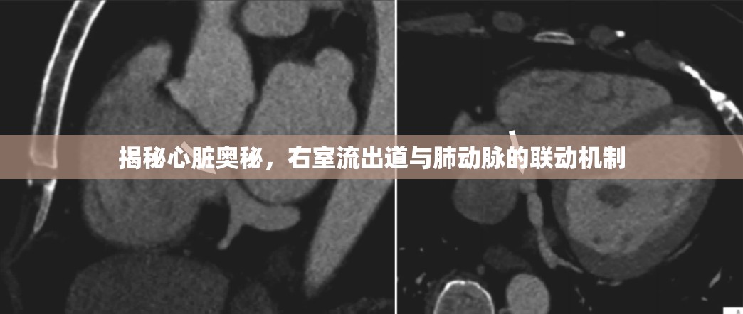 揭秘心臟奧秘，右室流出道與肺動(dòng)脈的聯(lián)動(dòng)機(jī)制