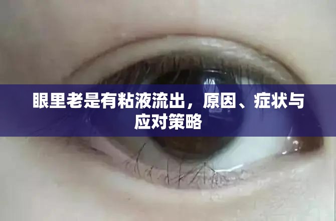 眼里老是有粘液流出，原因、癥狀與應(yīng)對(duì)策略