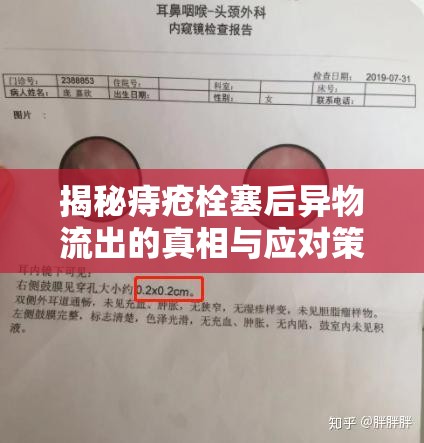 揭秘痔瘡栓塞后異物流出的真相與應(yīng)對(duì)策略