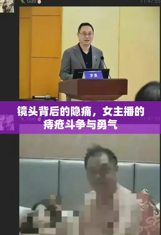 鏡頭背后的隱痛，女主播的痔瘡斗爭(zhēng)與勇氣