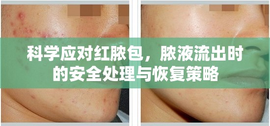 科學(xué)應(yīng)對(duì)紅膿包，膿液流出時(shí)的安全處理與恢復(fù)策略