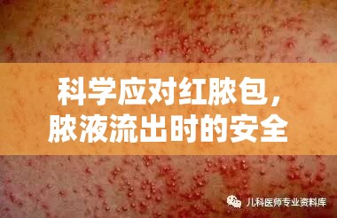 科學(xué)應(yīng)對(duì)紅膿包，膿液流出時(shí)的安全處理與恢復(fù)策略