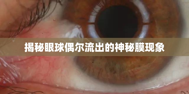 揭秘眼球偶爾流出的神秘膜現(xiàn)象