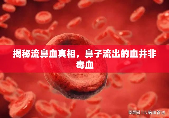 揭秘流鼻血真相，鼻子流出的血并非毒血