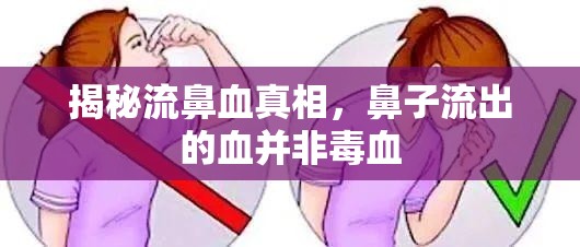 揭秘流鼻血真相，鼻子流出的血并非毒血