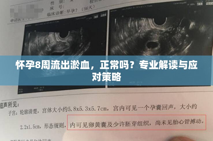 懷孕8周流出淤血，正常嗎？專業(yè)解讀與應(yīng)對(duì)策略