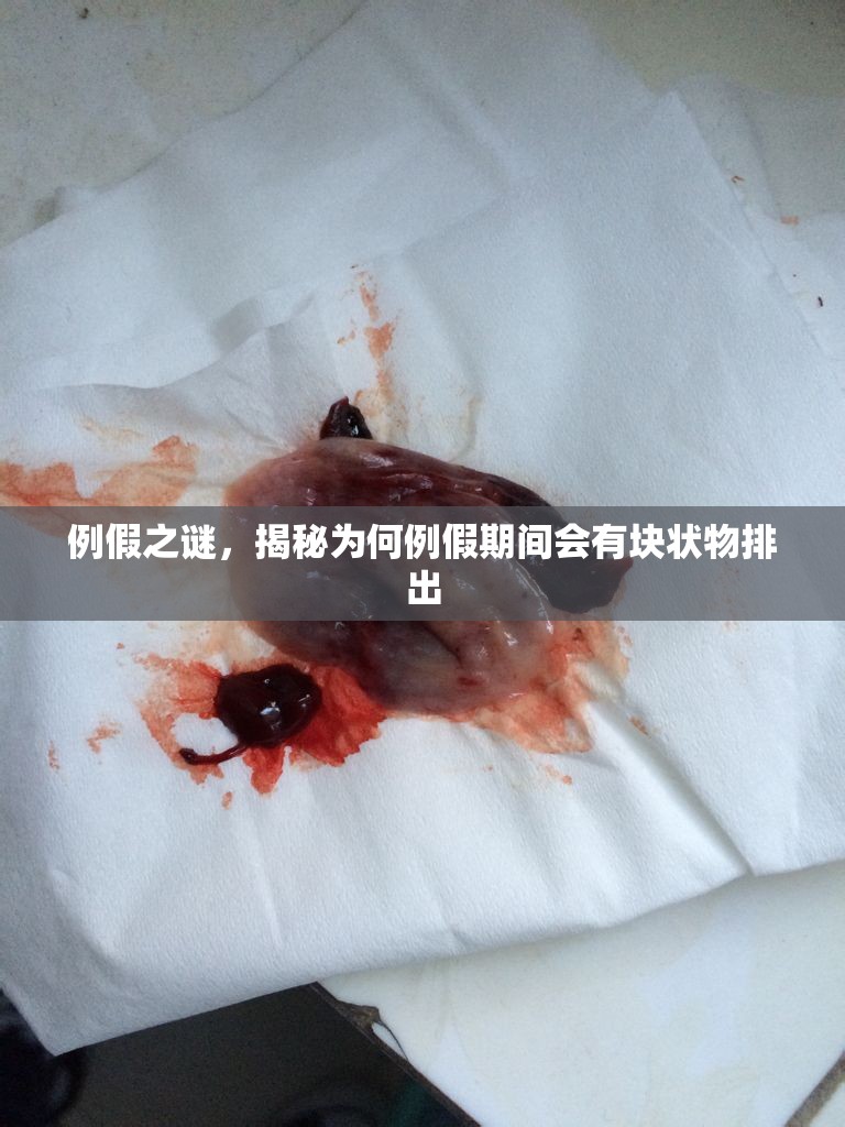 例假之謎，揭秘為何例假期間會有塊狀物排出