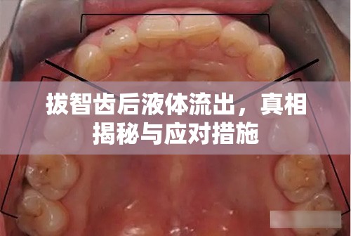 拔智齒后液體流出，真相揭秘與應(yīng)對(duì)措施