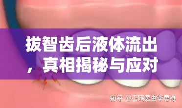 拔智齒后液體流出，真相揭秘與應(yīng)對(duì)措施
