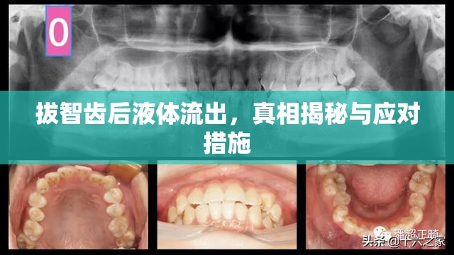 拔智齒后液體流出，真相揭秘與應(yīng)對(duì)措施