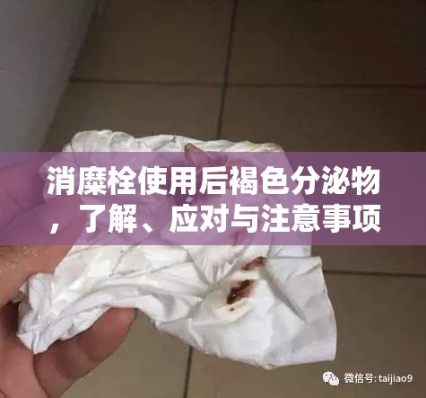 消糜栓使用后褐色分泌物，了解、應對與注意事項