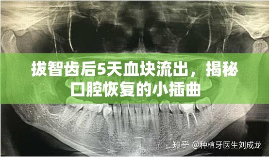 拔智齒后5天血塊流出，揭秘口腔恢復(fù)的小插曲