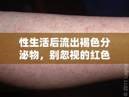 性生活后流出褐色分泌物，別忽視的紅色警報(bào)