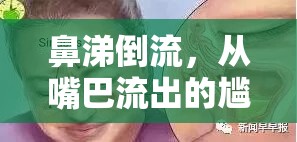 鼻涕倒流，從嘴巴流出的尷尬與健康