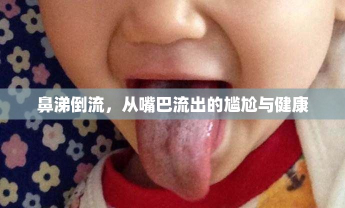 鼻涕倒流，從嘴巴流出的尷尬與健康