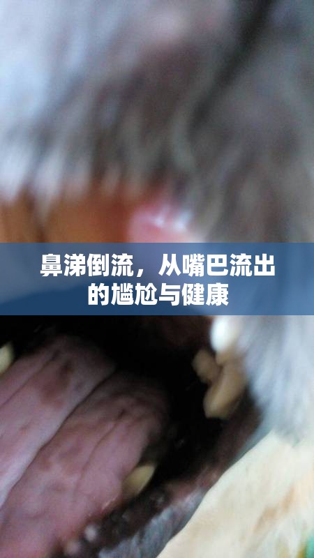 鼻涕倒流，從嘴巴流出的尷尬與健康