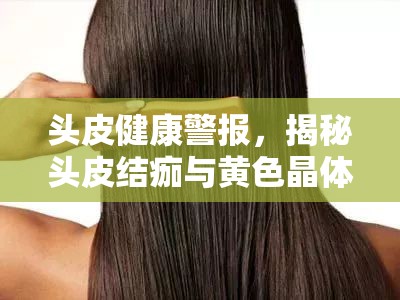 頭皮健康警報(bào)，揭秘頭皮結(jié)痂與黃色晶體流出的真相
