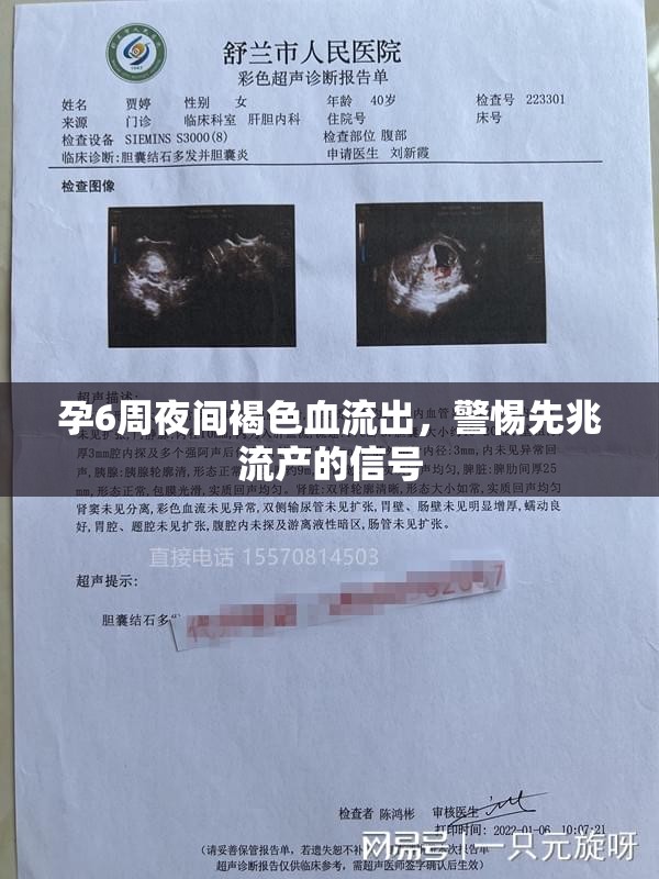 孕6周夜間褐色血流出，警惕先兆流產(chǎn)的信號