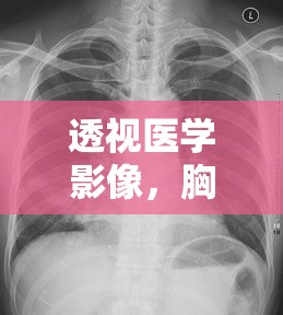 透視醫(yī)學(xué)影像，胸片曝光的奧秘與重要性