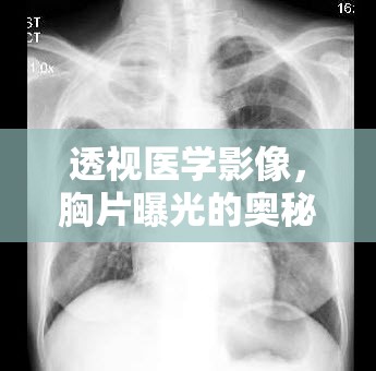 透視醫(yī)學(xué)影像，胸片曝光的奧秘與重要性