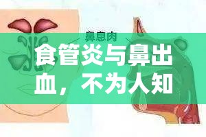 食管炎與鼻出血，不為人知的隱秘聯(lián)系