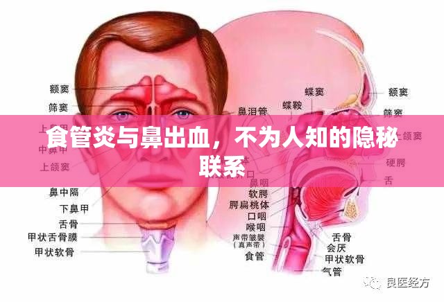 食管炎與鼻出血，不為人知的隱秘聯(lián)系