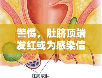 警惕，肚臍頂端發(fā)紅或?yàn)楦腥拘盘?hào)，粘液流出背后的真相