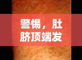 警惕，肚臍頂端發(fā)紅或?yàn)楦腥拘盘?hào)，粘液流出背后的真相