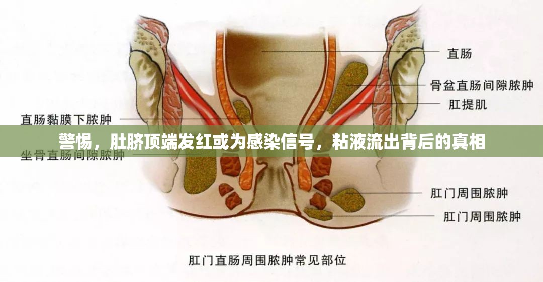 警惕，肚臍頂端發(fā)紅或?yàn)楦腥拘盘?hào)，粘液流出背后的真相