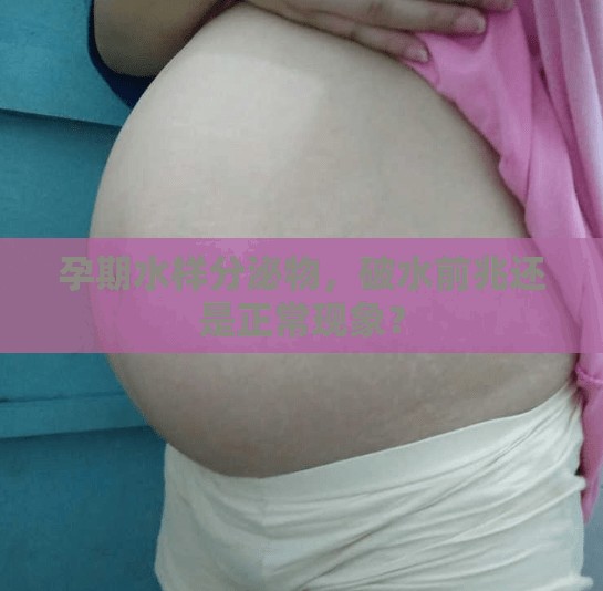孕期水樣分泌物，破水前兆還是正常現(xiàn)象？
